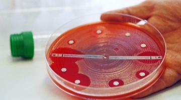 Бактерии выработали устойчивость к антибиотикам задолго до их открытия