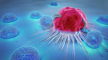 Найден способ избежать метастазов особо опасных видов рака
