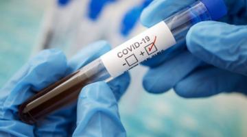 Пандемия: в мире COVID-19 заболели более 53 млн человек