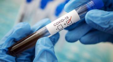 На Херсонщине за сутки не обнаружили ни одного случая коронавирусной инфекции